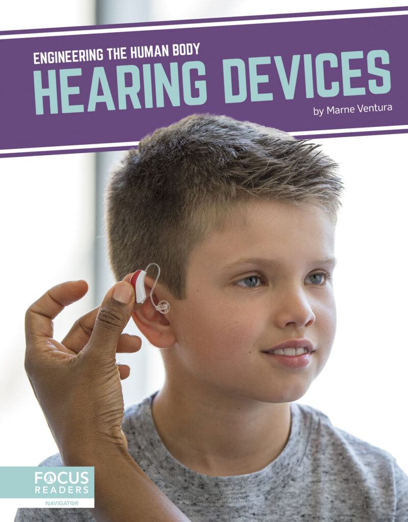 Introduces readers to the science behind hearing devices, including how and why the technology was created, current examples of the technology in action, and cutting-edge research advancing the technology. Eye-catching infographics, clear text, informative sidebars, and a “How It Works” special feature make this book an engaging introduction to this exciting technology.