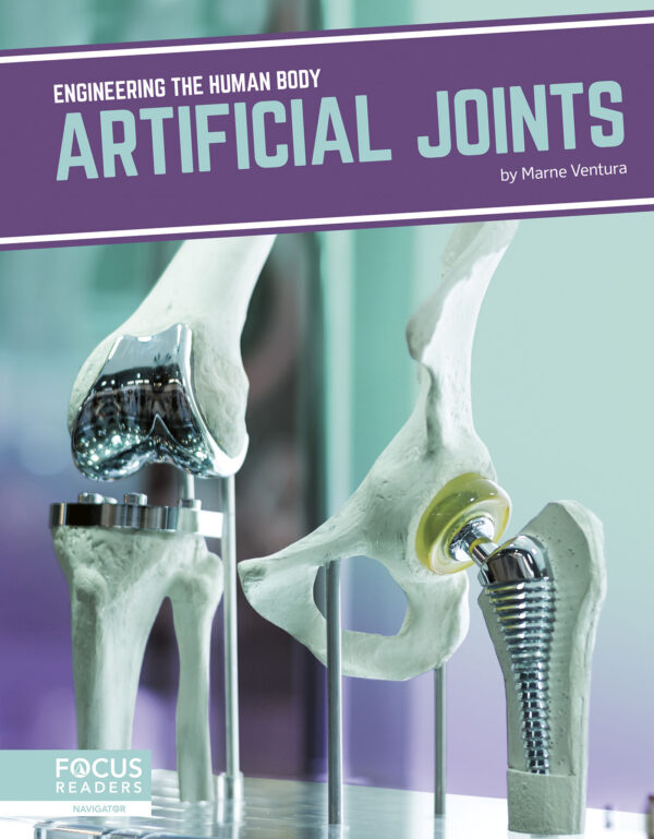 Artificial Joints