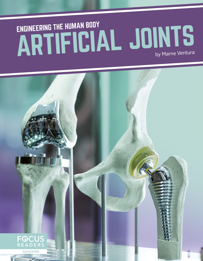 Introduces readers to the science behind artificial joints, including how and why the technology was created, current examples of the technology in action, and cutting-edge research advancing the technology. Eye-catching infographics, clear text, informative sidebars, and a “How It Works” special feature make this book an engaging introduction to this exciting technology.