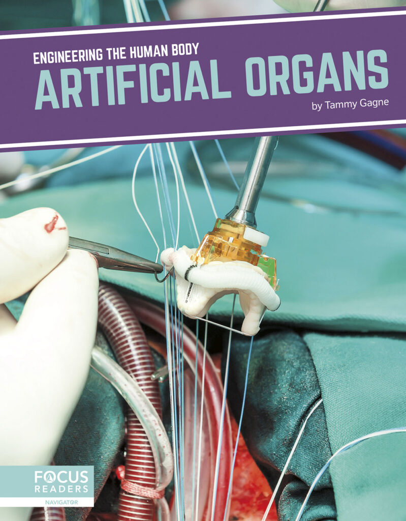 Introduces readers to the science behind artificial organs, including how and why the technology was created, current examples of the technology in action, and cutting-edge research advancing the technology. Eye-catching infographics, clear text, informative sidebars, and a “How It Works” special feature make this book an engaging introduction to this exciting technology.